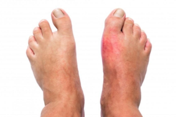 Peripheral Neuropathy Care in Thane