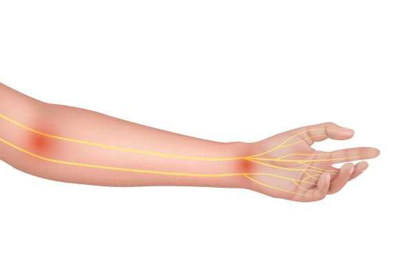 Expert Management of Nerve Entrapment Conditions in Thane