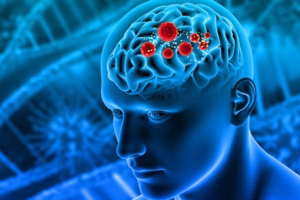 Best Neurosurgeon in Thane for Brain Tumor Treatment