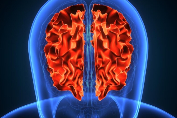 Best Care for Brain Hemorrhage in Thane: Comprehensive Neurological Solutions
