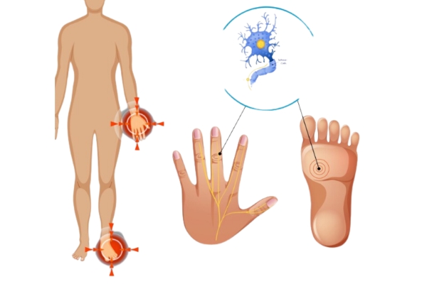 Best Peripheral Neuropathy Specialist in Thane: Expert Nerve Care