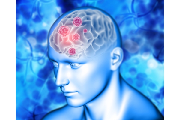 Best Meningitis Treatment in Thane: Protecting Your Brain and Spinal Cord