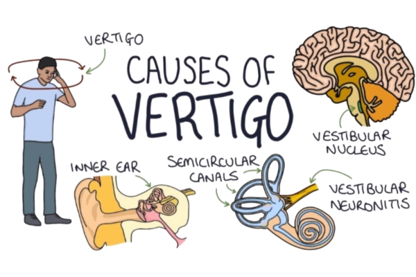 Vertigo Treatment in Thane - Dr. Deepak Aiwale Best Vertigo Specialist Near Me When vertigo disrupts