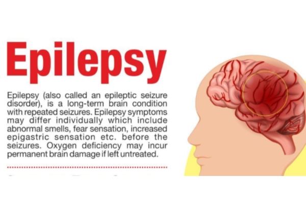 Epilepsy and Seizure Management in Thane - Dr. Deepak Aiwale Best Epilepsy Specialist Near Me